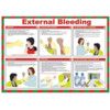 SAFETY POSTER - EXTERNAL BLEEDING thumbnail-0